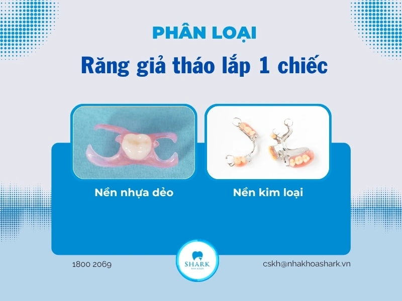 Răng giả đơn lẻ có 2 loại phổ biến hiện nay