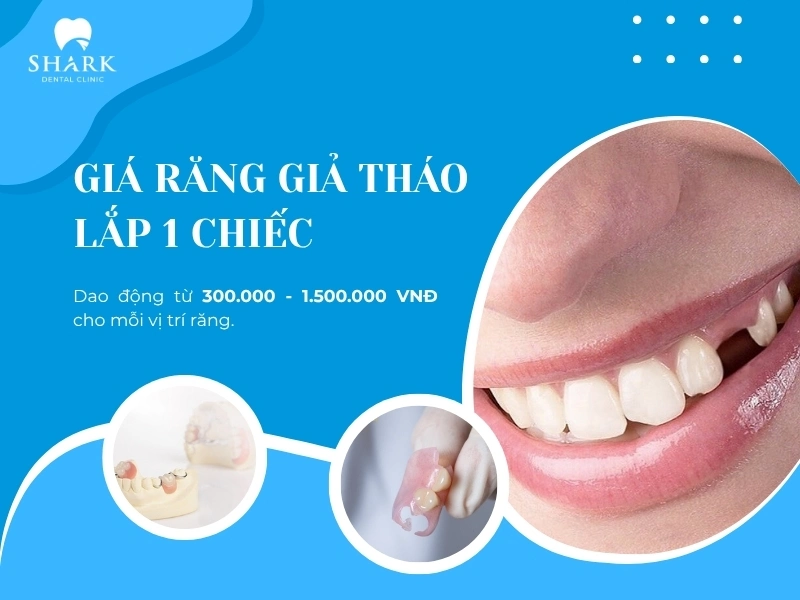 Giá để sở hữu 1 răng giả tháo lắp