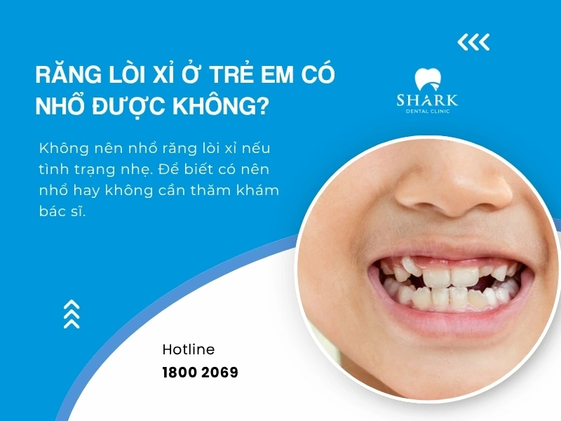 Việc có nên nhổ răng lòi xỉ hay không cần thăm khám trực tiếp với bác sĩ
