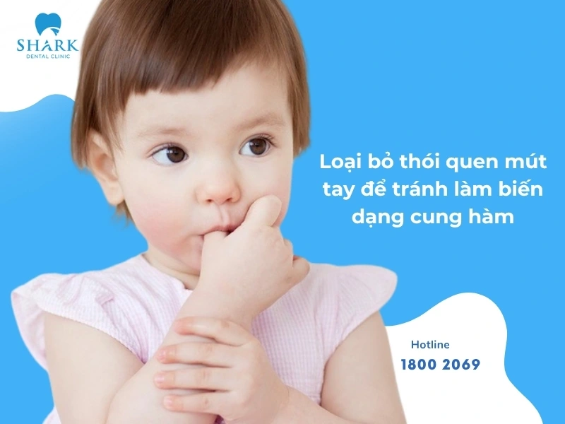 Loại bỏ thói quen mút tay cho trẻ ngay từ nhỏ đến tránh răng lòi xỉ