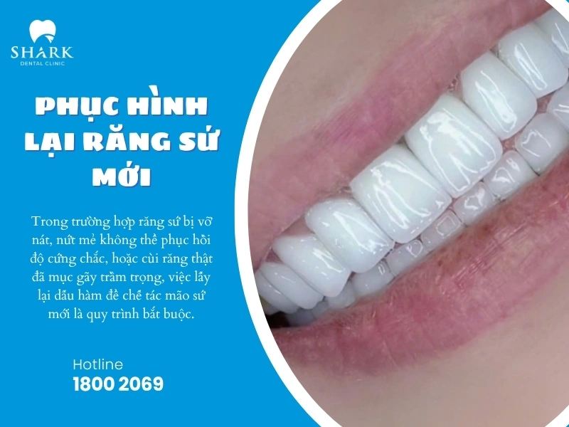 Phục hình lại răng sứ mới nếu mão sứ rơi vỡ nặng