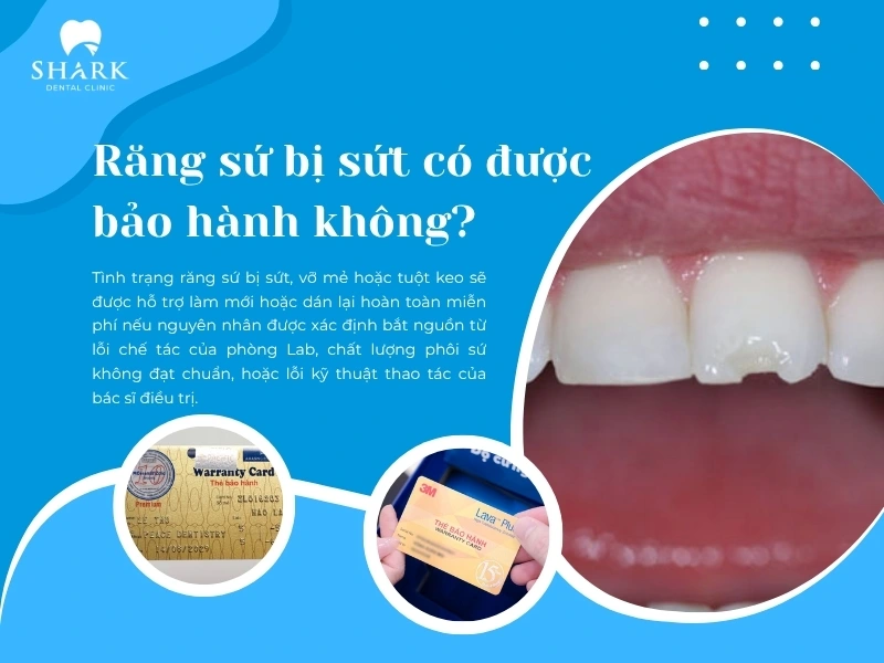 Nhiều cơ sở nha khoa uy tín có chính sách bảo hành cho răng sứ