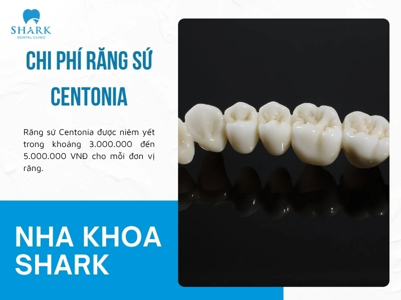 Giá bọc răng sứ Centonia ở phân khúc tầm trung