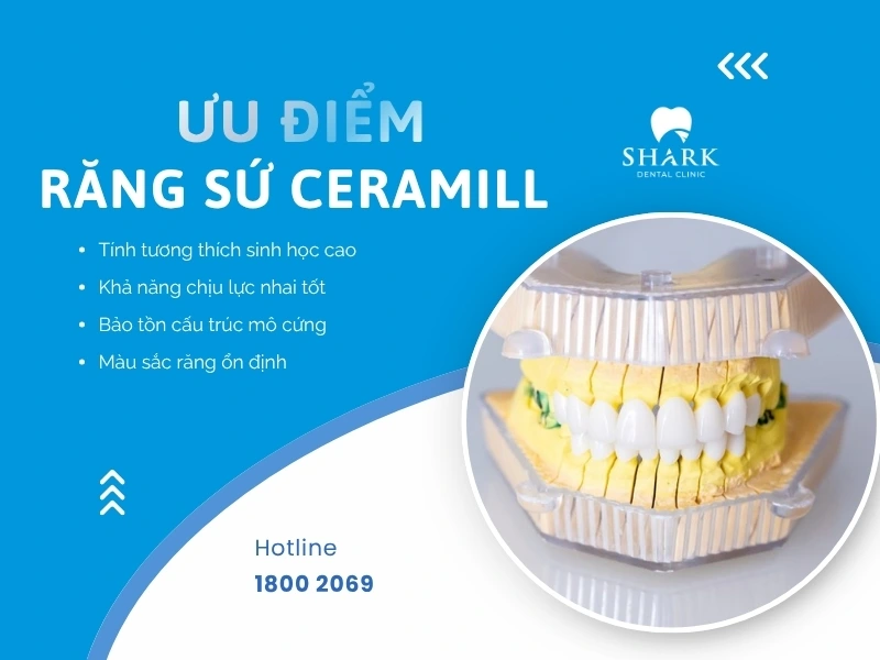 Sứ Ceramill có nhiều đặc tính tối ưu