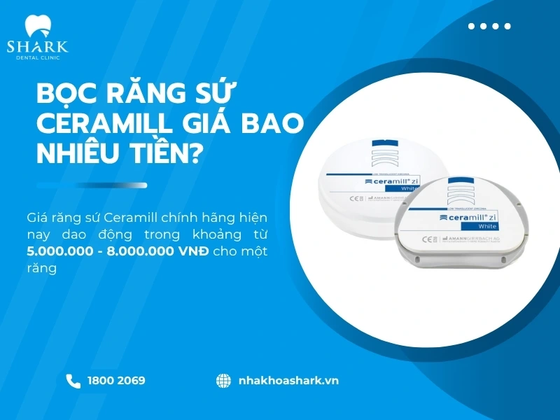 Chi phí bọc sứ Ceramill