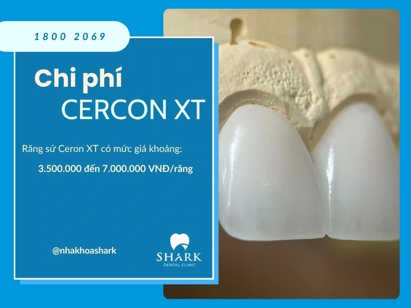 Chi phí bọc sứ Cercon XT tại Nha khoa Shark vô cùng hấp dẫn và tiết kiệm