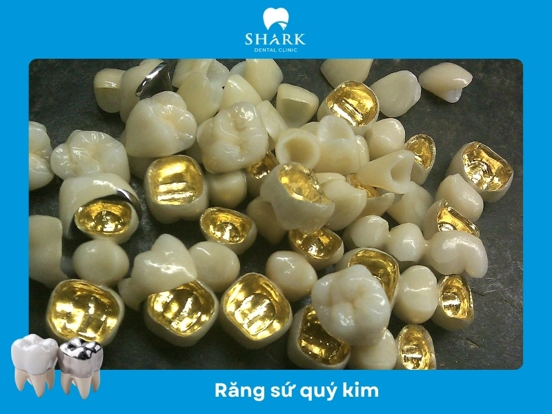 Răng sứ quý kim