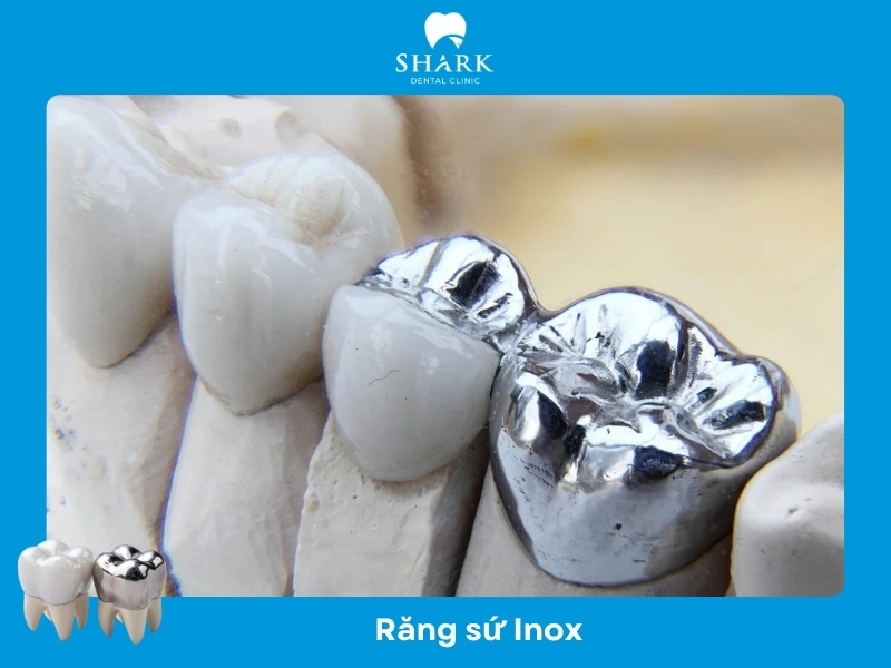 Răng sứ Inox