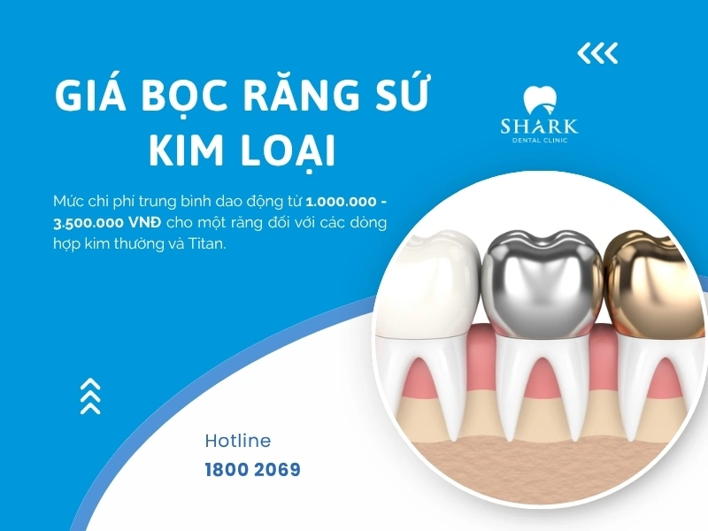 Chi phí bọc răng sứ phù hợp với đại đa số người dùng