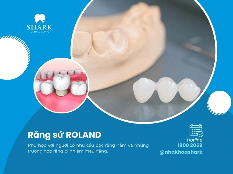 Răng sứ Roland phù hợp với những người có răng bị nhiễm màu nặng