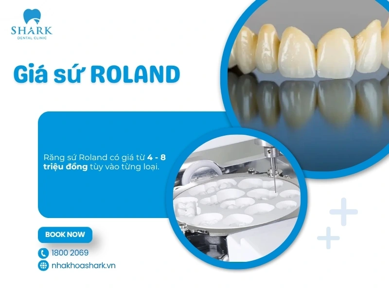 Răng sứ Roland có giá thuộc phân khúc tầm trung