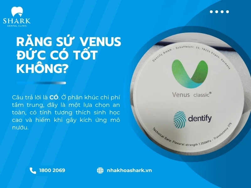 Răng sứ Venus là loại sứ phù hợp với nhiều người vì cân đối giữa chất lượng và giá thành