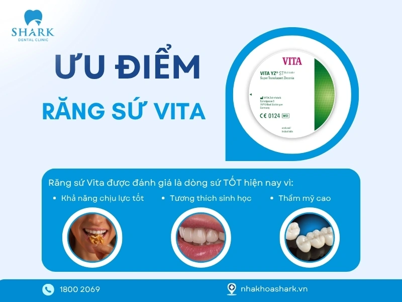 Răng sứ Vita được nhiều người dùng tin tưởng lựa chọn
