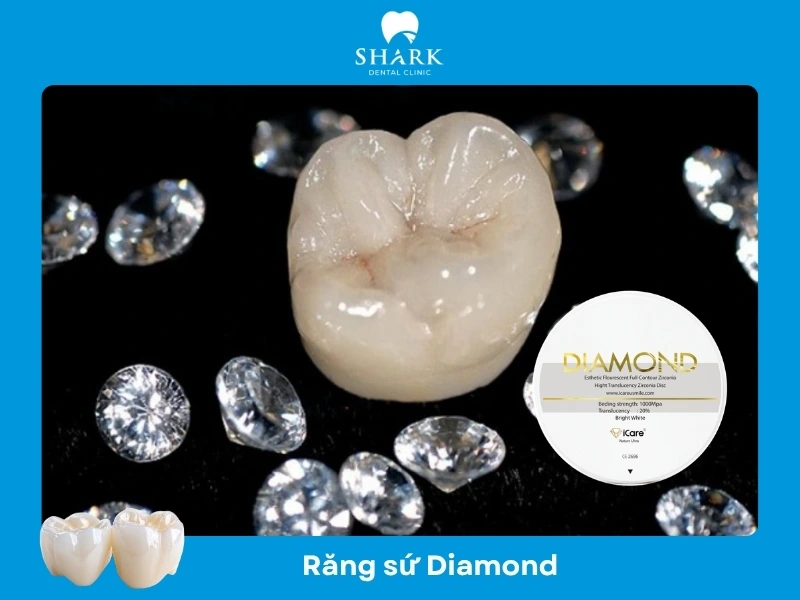 Răng sứ Diamond