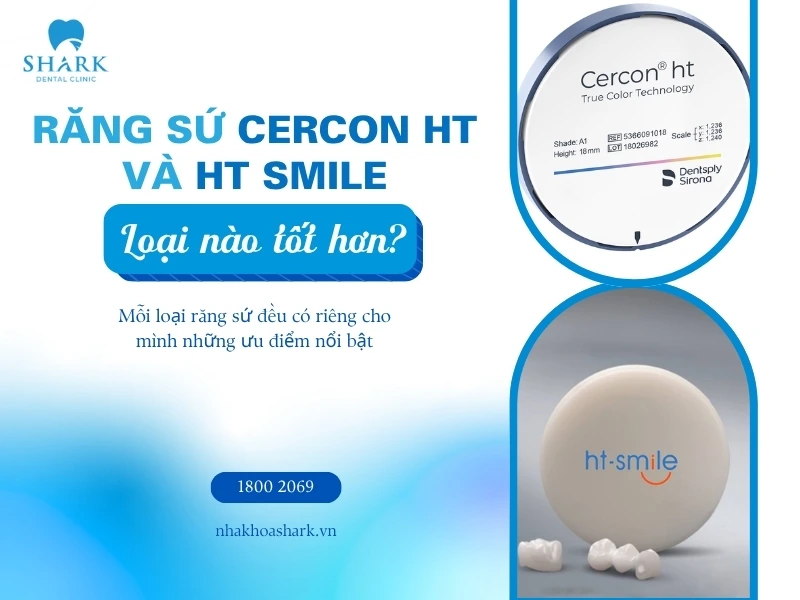Nên chọn sứ Cercon HT hay HT Smile sẽ tốt hơn