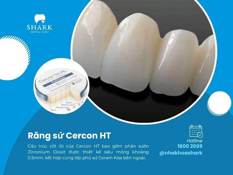 Răng sứ Cercon HT