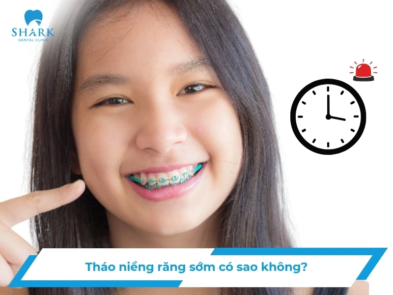Tháo niềng răng sớm có sao không