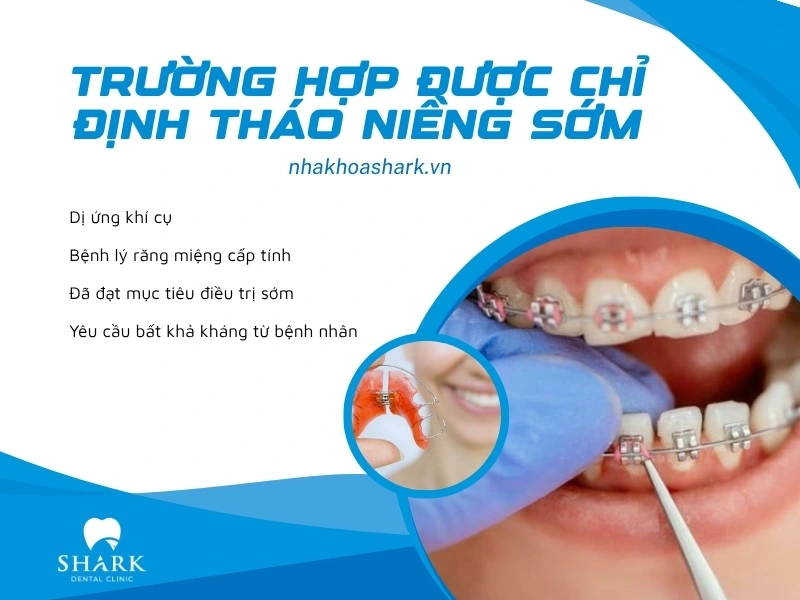 Chỉ được tháo niềng răng sớm khi có chỉ định từ bác sĩ