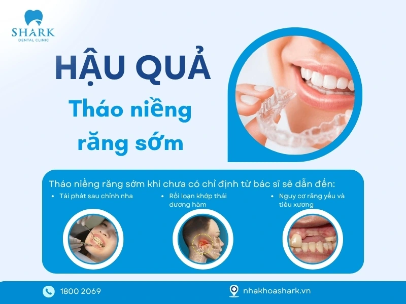 Tháo sớm niềng răng dễ dẫn đến các hậu quả nghiêm trong cho sức khỏe răng miệng