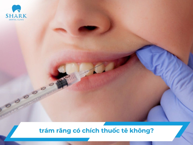 trám răng có chích thuốc tê không