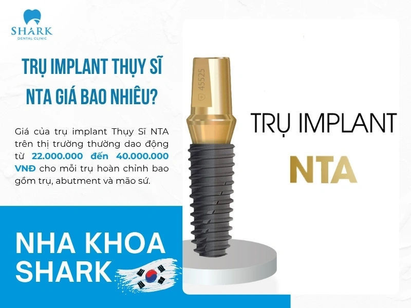 Chi phí trồng răng NTA phù hợp với người Việt Nam