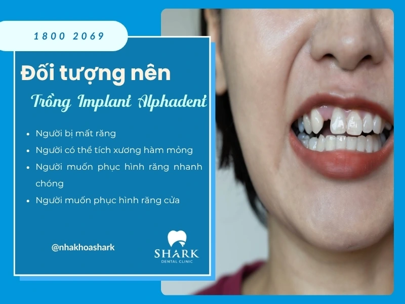 Người mất răng ở mọi vị trí đều có thể trồng trụ Alphadent