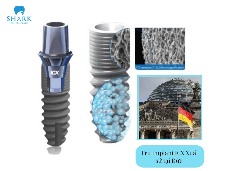 Trụ Implant ICX là một trong những dòng trụ cao cấp đến từ Đức