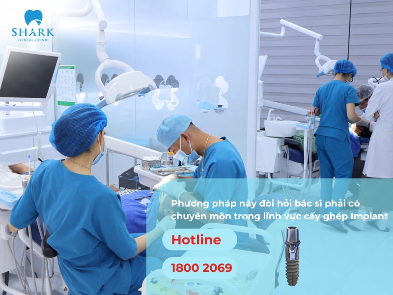 Phương pháp này đòi hỏi bác sĩ phải có tay nghề vững vàng và am hiểu về lĩnh vực cấy ghép Implant