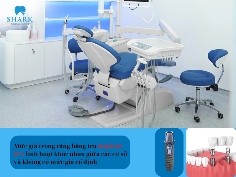Mức giá trồng răng bằng trụ Implant ICX thường linh hoạt khác nhau giữa các cơ sở mà không có mức giá cố định