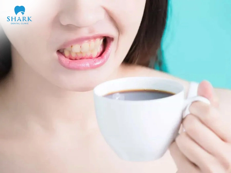 Sử dụng nhiều thực phẩm sẫm màu khiến cho miếng trám răng bị đổi màu