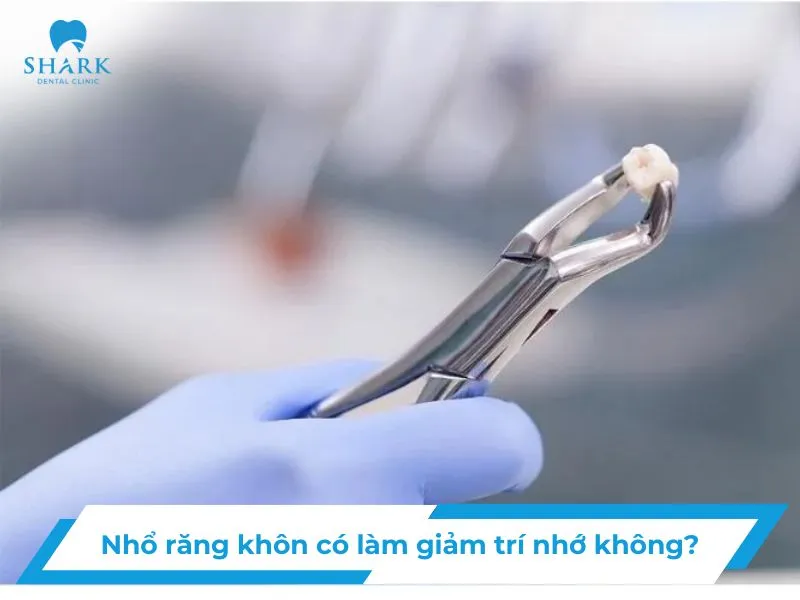 nho-rang-khon-co-lam-giam-tri-nho-khong