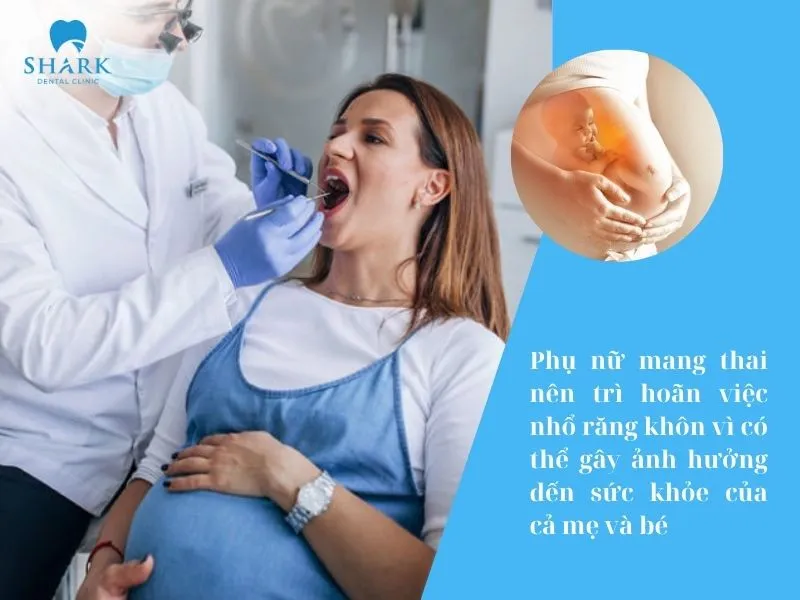 Nhổ răng khôn có làm giảm trí nhớ không? Góc nhìn chuyên gia 10 Phụ nữ mang thai nên trì hoãn việc nhổ răng khôn vì có thể gây ảnh hưởng đến sức khỏe của cả mẹ và bé