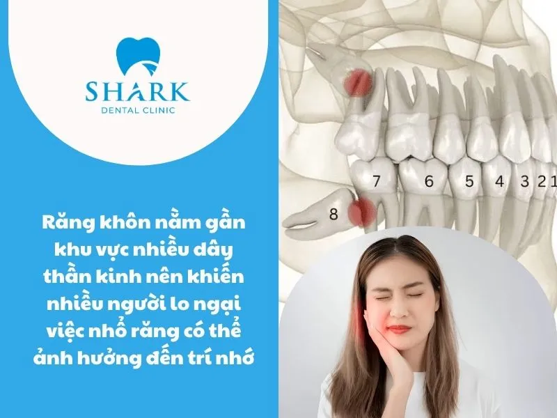 Nhổ răng khôn có làm giảm trí nhớ không? Góc nhìn chuyên gia 8 Răng khôn nằm gần khu vực nhiều dây thần kinh nên khiến nhiều người lo ngại việc nhổ răng có thể ảnh hưởng đến trí nhớ