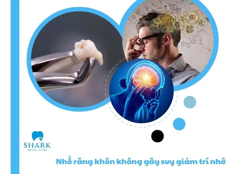 Nhổ răng khôn có làm giảm trí nhớ không? Góc nhìn chuyên gia 7 Nhổ răng khôn không gây suy giảm trí nhớ hay ảnh hưởng đến khả năng nhận thức của con người
