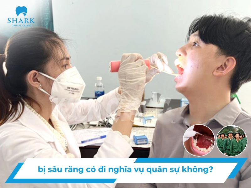 bị sâu răng có đi nghĩa vụ quân sự không?