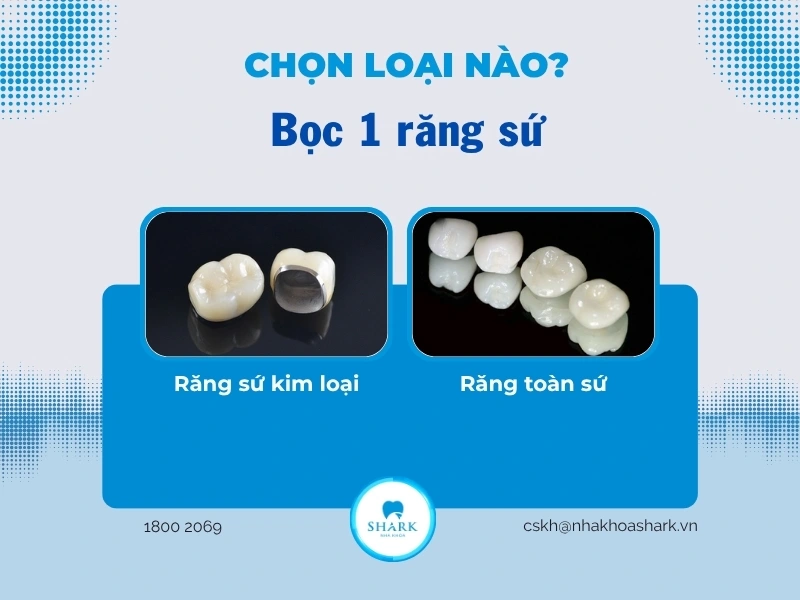 Bọc răng sứ 1 chiếc được không? Giá bao nhiêu tiền? 12 Phân loại 2 nhóm răng sứ phổ biến hiện nay