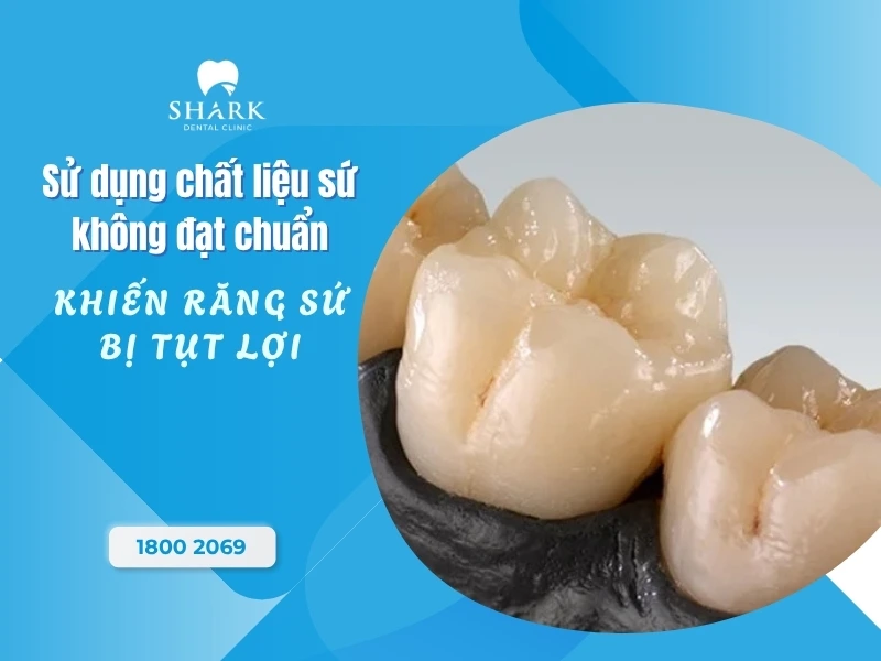 Chất liệu sứ kém hoặc dòng răng sứ kim loại dễ bị tụt lợi