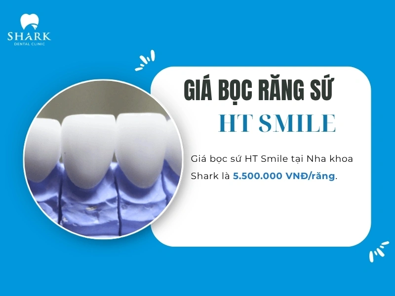 Chi phí bọc răng sứ HT Smile được niêm yết tại Nha khoa Shark