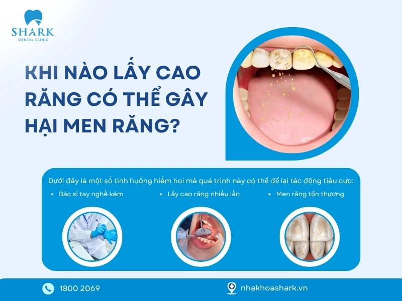 Bác sĩ giải đáp: Lấy cao răng có làm mòn men răng không? 14 3 rủi ro khi lấy vôi răng làm ảnh hưởng đến men răng