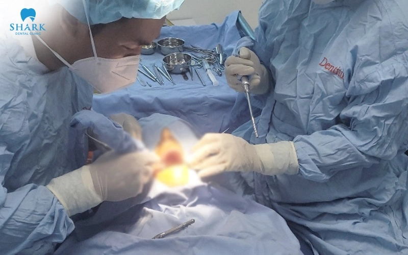 Bác sĩ nha khoa cần biết rõ tình trạng bệnh trước khi cấy ghép răng