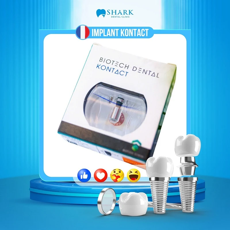 Khách hàng lựa chọn trụ Implant Pháp tại Nha khoa Shark