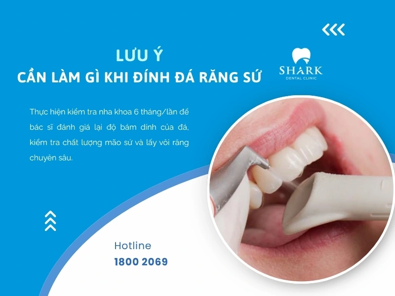 Hãy tái khám định kỳ để kiểm tra tình trạng răng sứ cùng đá đính