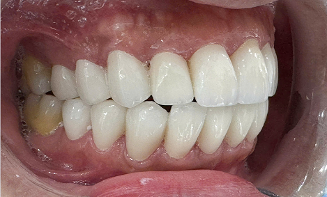 Kết quả điều trị của Jeffrey Carlo