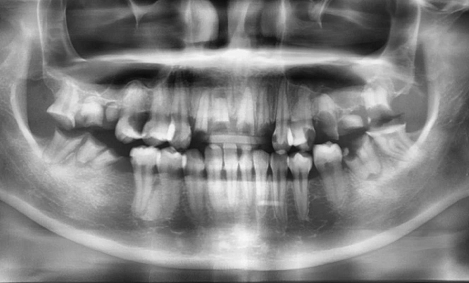 Kết quả điều trị Võ Thị Bảo Ngân