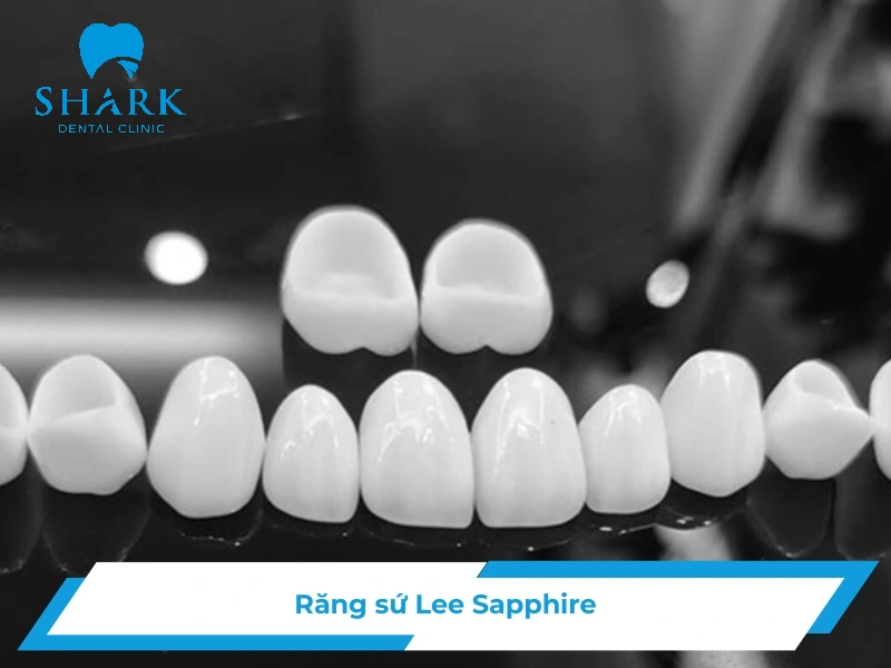 Răng sứ Lee Sapphire giá bao nhiêu? Giữ màu được bao lâu? 24 Răng sứ Lee Sapphire