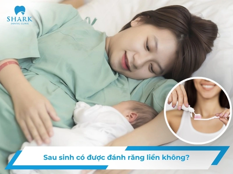 Sau sinh bao lâu thì đánh răng? Hướng dẫn từ bác sĩ nha khoa 29 Mới sinh bao lâu được đánh răng