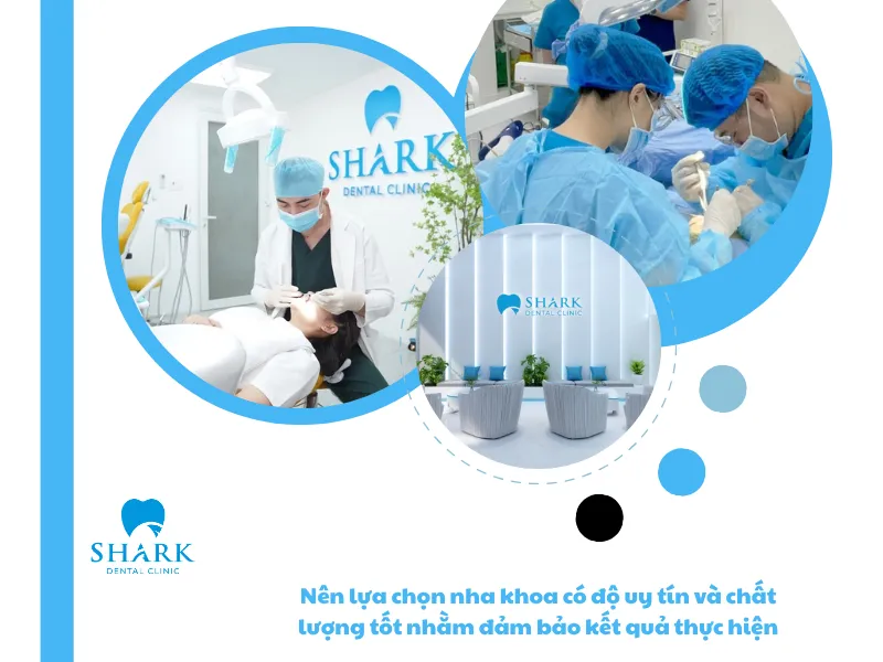 Nên lựa chọn nha khoa có độ uy tín và chất lượng tốt nhằm đảm bảo kết quả thực hiện