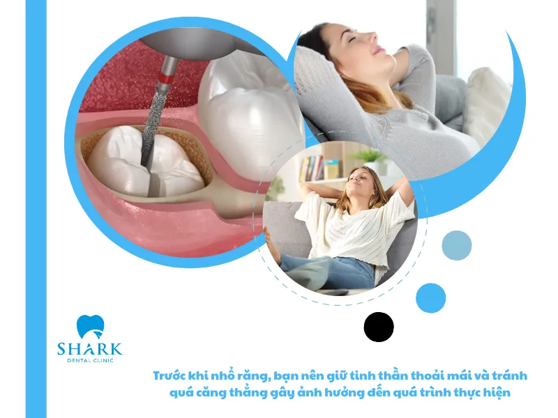 Trước khi nhổ răng, bạn nên giữ tinh thần thoải mái và tránh quá căng thẳng gây ảnh hưởng đến quá trình thực hiện
