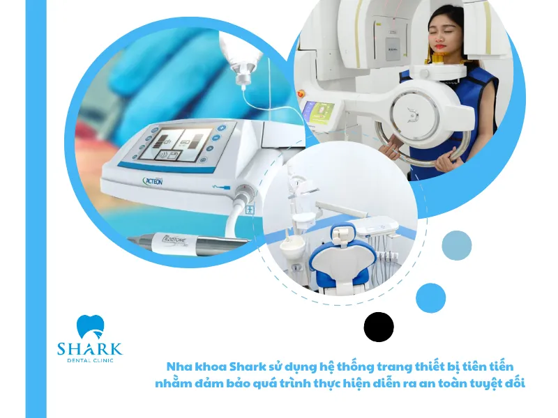 Nha khoa Shark sử dụng hệ thống trang thiết bị tiên tiến nhằm đảm bảo quá trình thực hiện diễn ra an toàn tuyệt đối