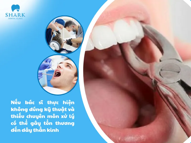 Nếu bác sĩ thực hiện không đúng kỹ thuật và thiếu chuyên môn xử lý có thể gây tổn thương đến dây thần kinh